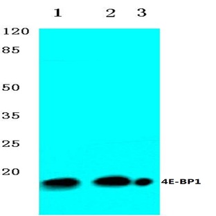 4E-BP1 (G39) pAb