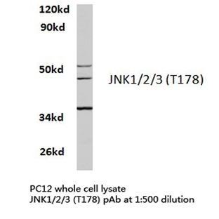 JNK1/2/3 (T178) pAb