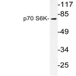 p70 S6K (F428) pAb