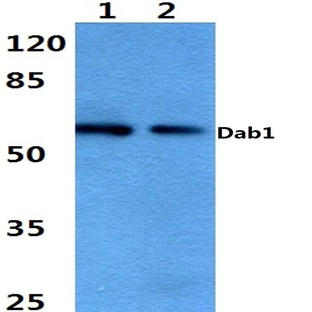 Dab1 (E214) pAb