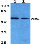 Dab1 (E214) pAb