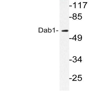 Dab1 (Q226) pAb