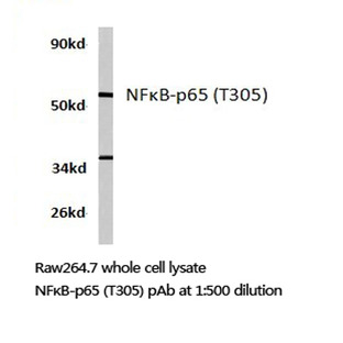 NFkB-p65 (T305) pAb