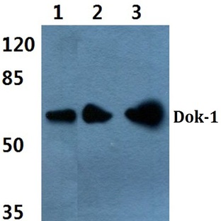 Dok-1 (P356) pAb