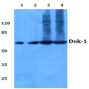 Dok-1 (R392) pAb