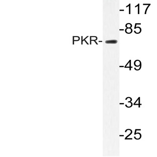 PKR (K440) pAb