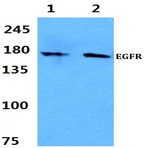 EGFR (S1104) pAb