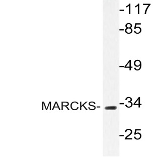 MARCKS (R157) pAb