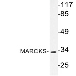 MARCKS (R157) pAb