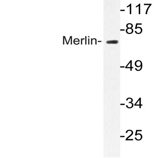 Merlin (T512) pAb