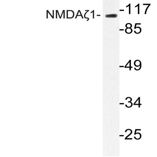 NMDA?1 (F891) pAb