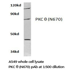 PKC 0 (N670) pAb