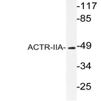 ACTR-IIA (H59) pAb