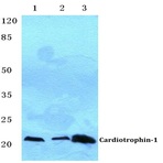 Cardiotrophin-1 (H31) pAb