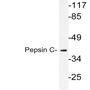 Pepsin C (F306) pAb