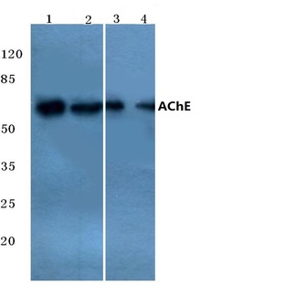 AChE (K585) pAb