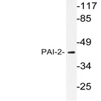 PAI-2 (V307) pAb