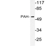 PAH (R400) pAb