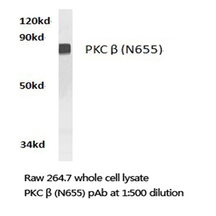 PKC (beta) (N655) pAb