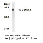 PKC (beta) (N655) pAb