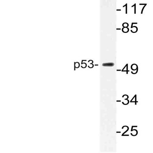 p53 (V31) pAb