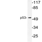 p53 (V31) pAb