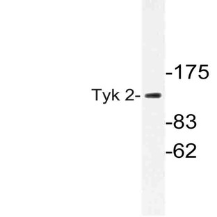 TYK2 (V1048) pAb