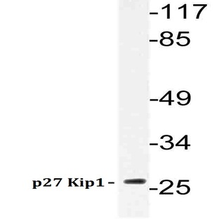 p27 Kip1 (A181) pAb