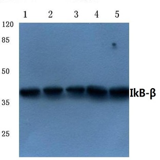 IkB-(beta) (A13) pAb 