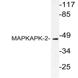 MAPKAPK-2 (N218) pAb