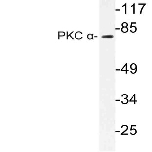 PKC (alpha) (E653) pAb