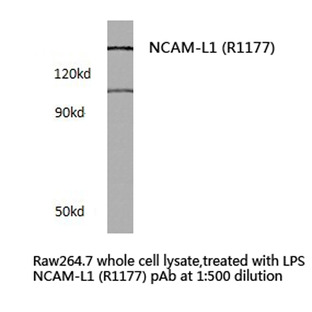 NCAM-L1 (R1177) pAb