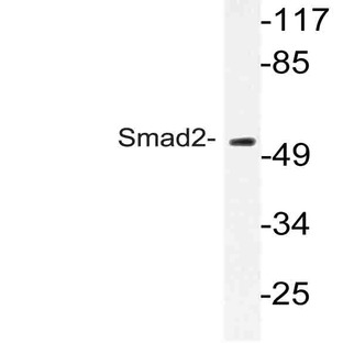 Smad2 (P251) pAb