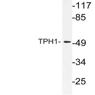 TPH1 (V256) pAb