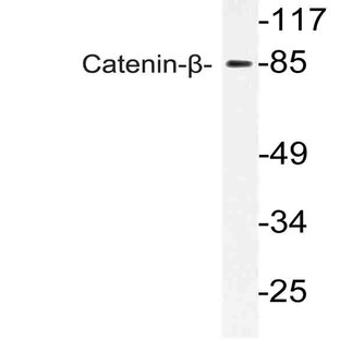 Catenin-(beta) (Q482) pAb