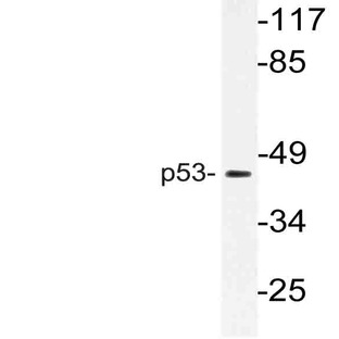 p53 (S371) pAb