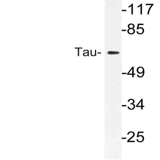 Tau (S527) pAb