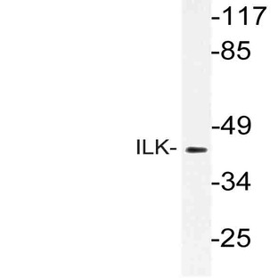 ILK (P240) pAb