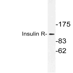 Insulin Receptor (K1368) pAb