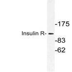 Insulin Receptor (K1368) pAb