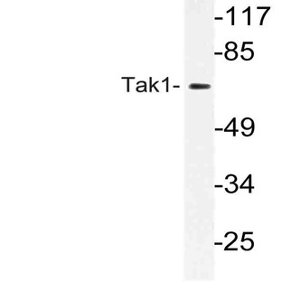 Tak1 (D181) pAb