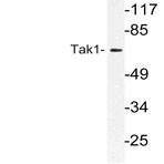 Tak1 (D181) pAb