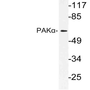 PAK1 (K198) pAb