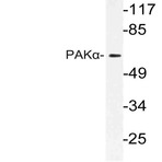 PAK1 (K198) pAb