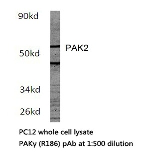 PAK2 (R186) pAb