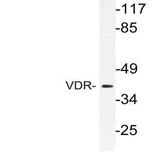 VDR (K45) pAb