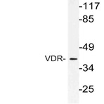 VDR (K45) pAb