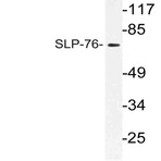 SLP-76 (G122) pAb