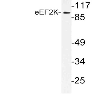 eEF2K (G358) pAb