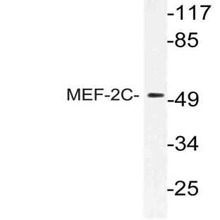 MEF-2C (I390) pAb